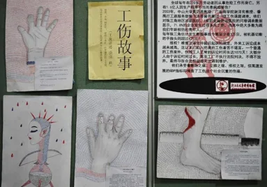展板题为“工伤故事”,两侧配有描绘伤手的插画(其中一幅带红色伤痕),右下角另有一张脚部受伤的照片,具体说明文字较小模糊难辨。